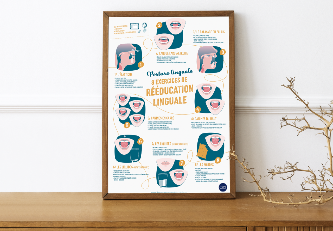 Boîte de Affiche A2 - Posture linguale
