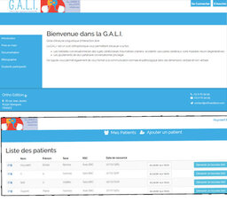 GALI