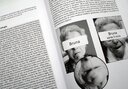 La Douleur en Orthophonie, de la Théorie à la Pratique